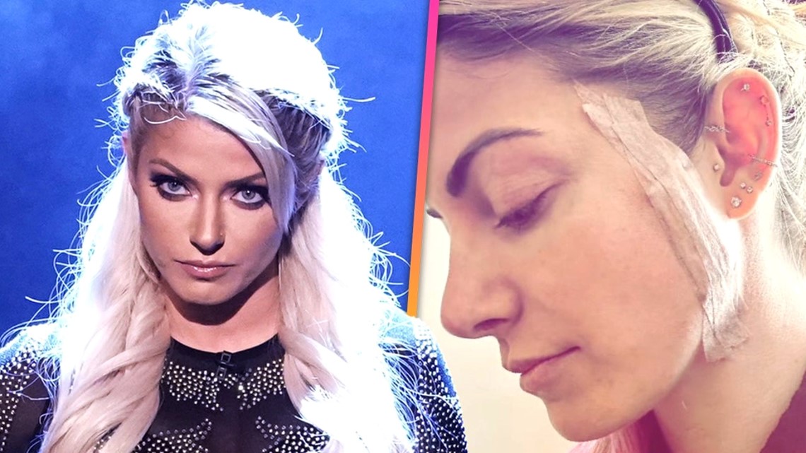 Wwe Star Alexa Bliss Reveals Skin Cancer Diagnosis Shares Message To