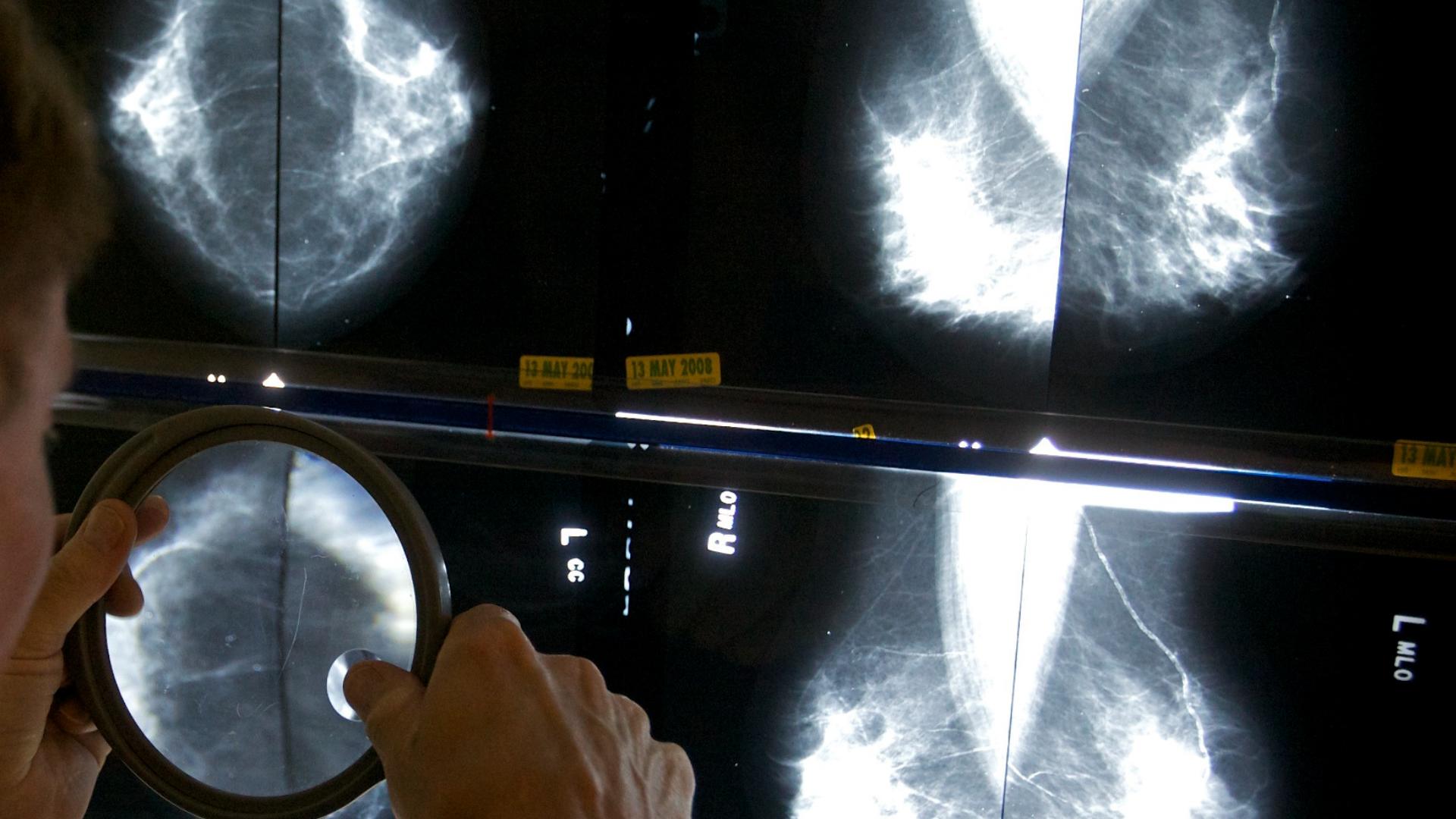 A panel of experts said women with an average risk of developing breast cancer should start getting mammograms every other year, starting at age 40.