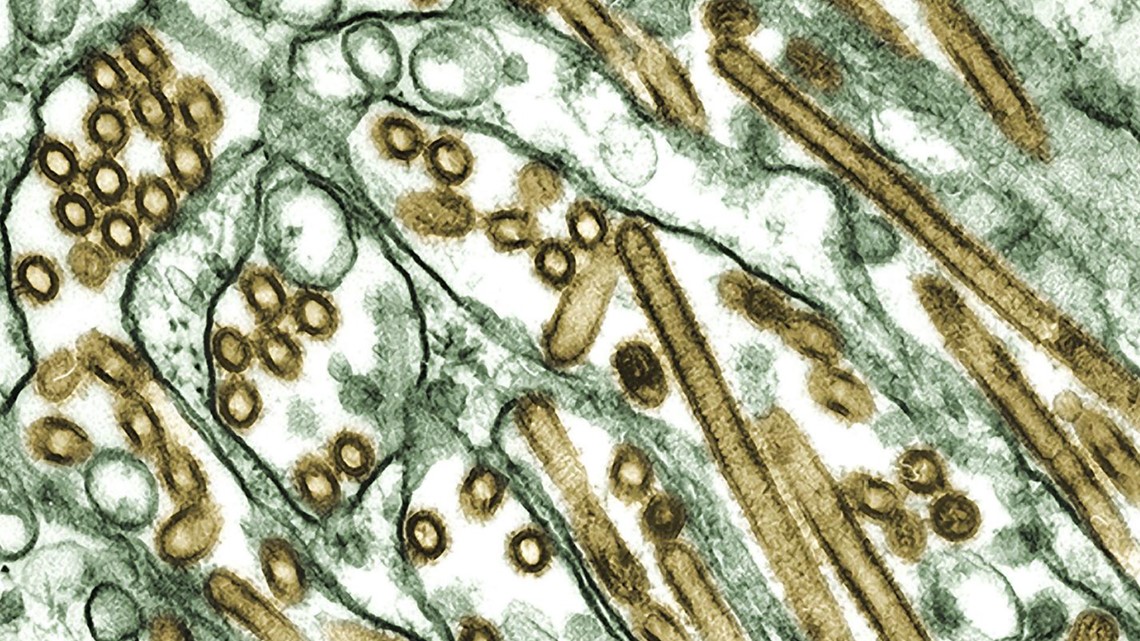 Bird flu: Texas DSHS reports human case - Vimarsana News