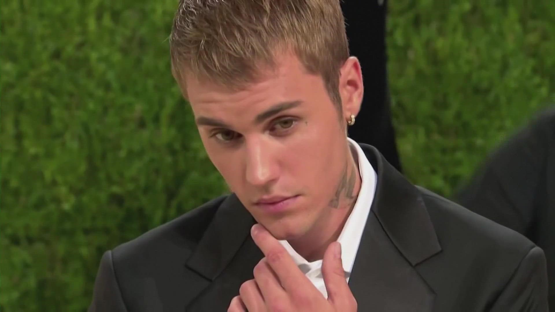 Justin Bieber Reveals Why Half His Face Is Paralyzed, Cancels Tour