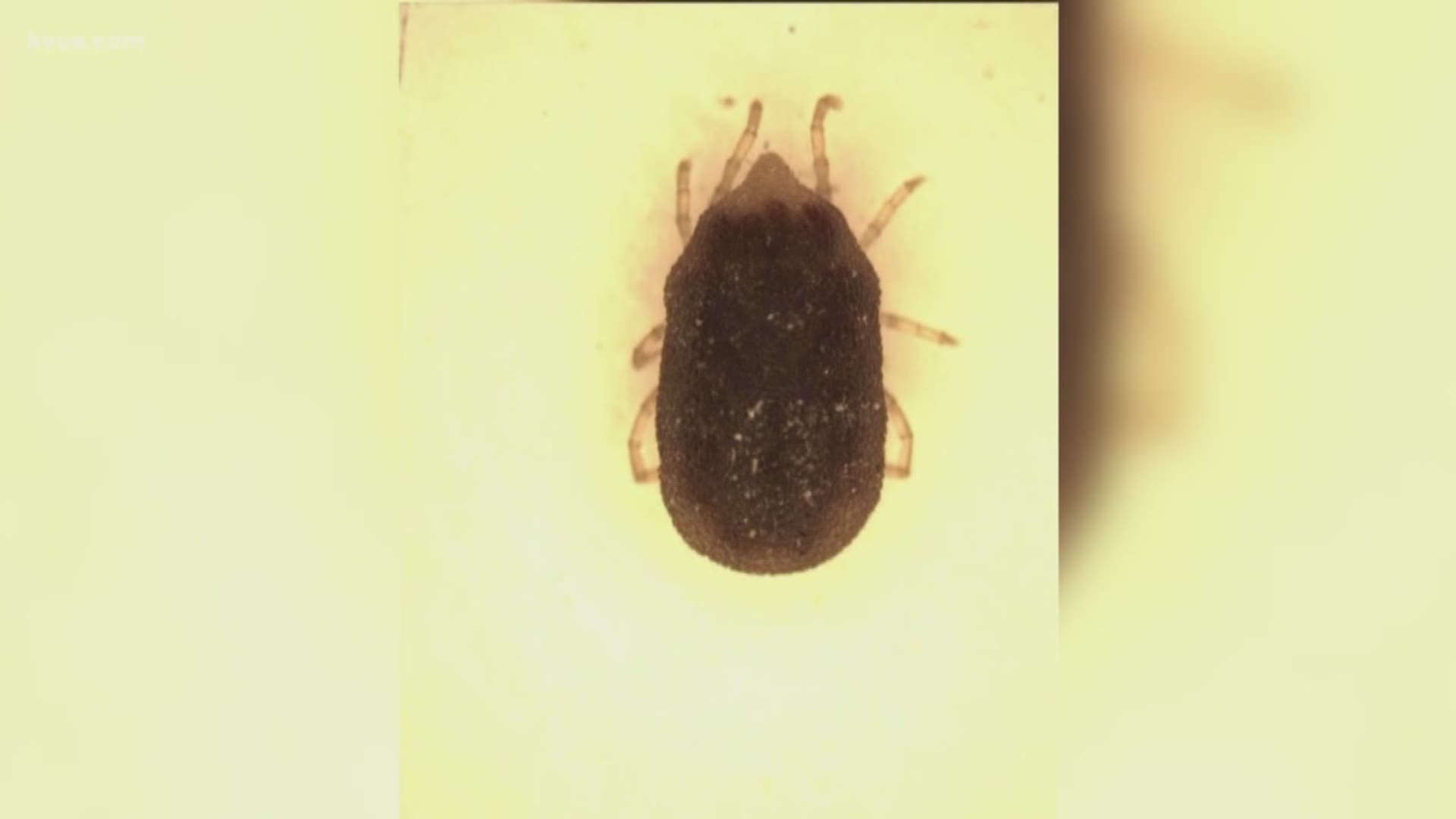 Austin health officials are reporting a jump in cases of a rare, tick-borne infection. It's spread from ticks that live in the western part of the country -- including in Austin-area caves.