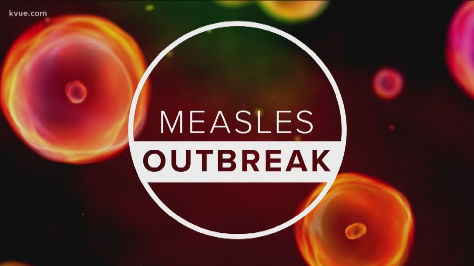 Health officials said there haven't been any new measles cases since the first last month.