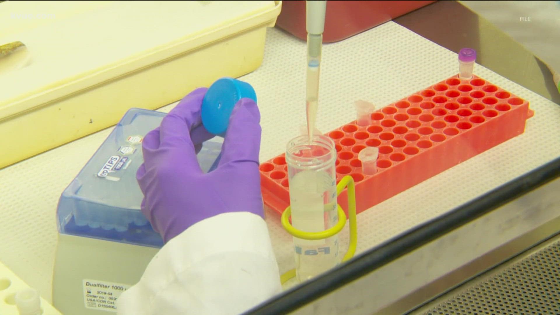 Austin researchers are looking for adults to take part in vaccine clinical trials.