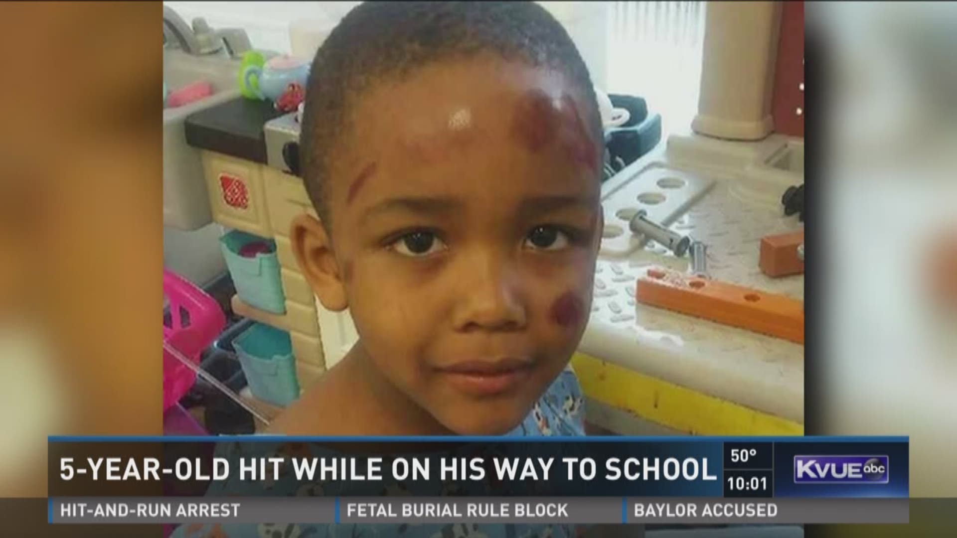 5-year-old hit while on his way to school