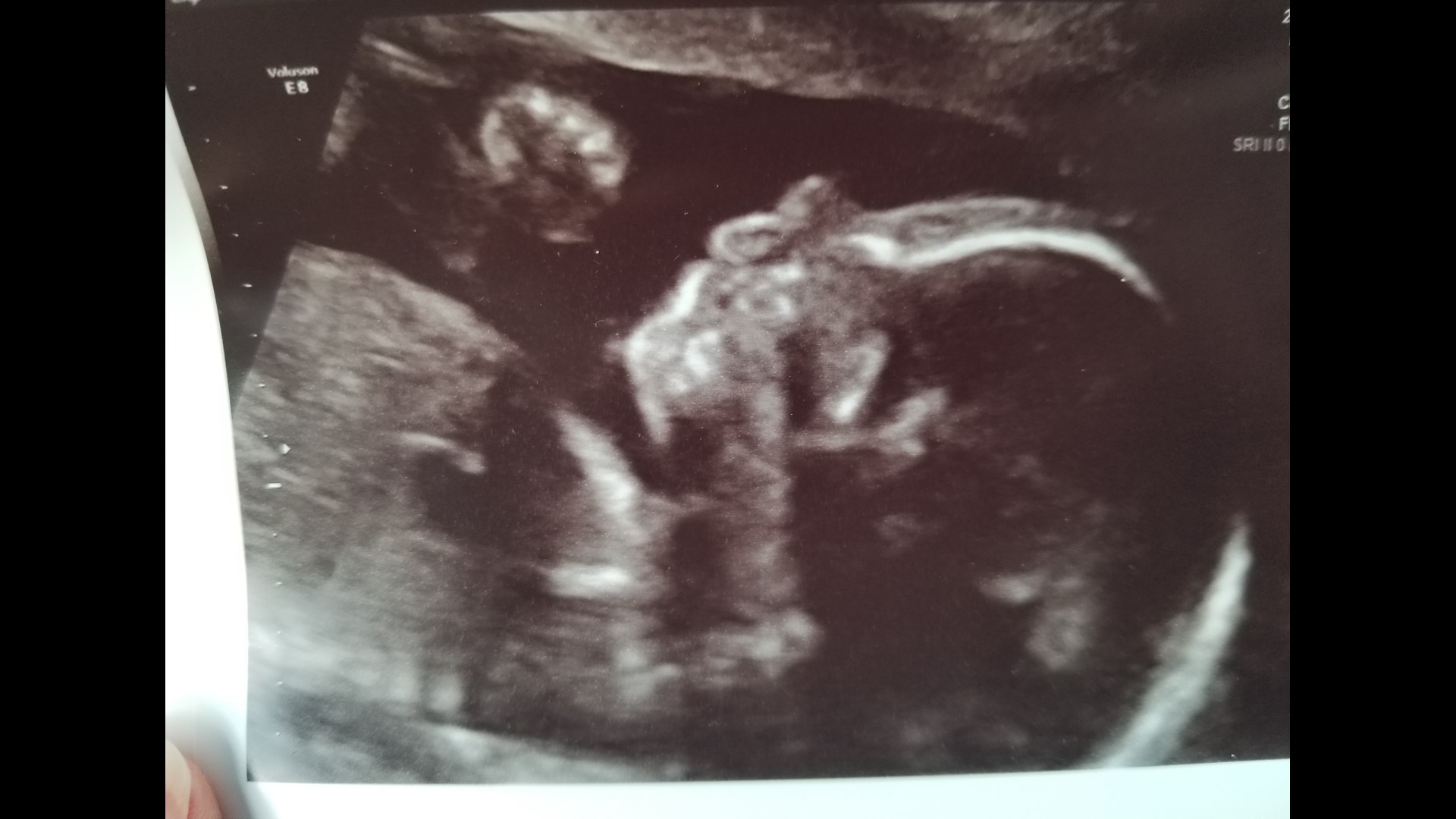 Aggie couple's baby throws up 'hook 'em' sign on ultrasound photo