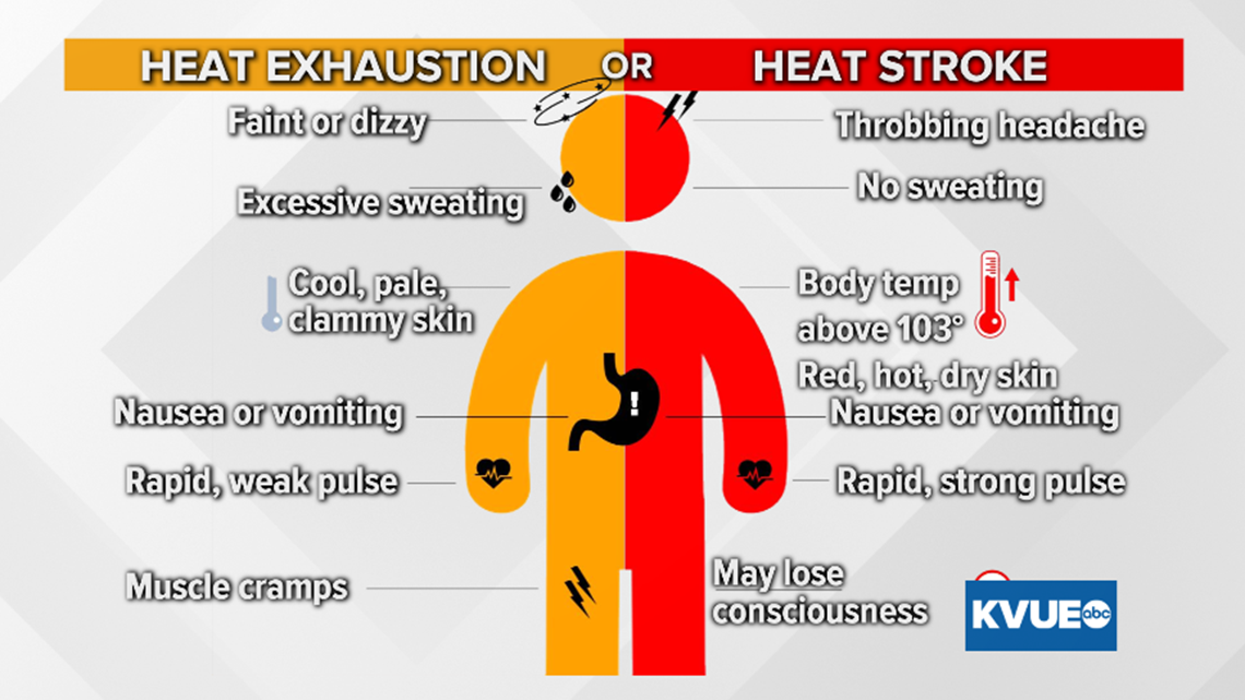 Heat Stroke Vs. Heat Exhaustion: Know The Warning Signs | Kvue.com