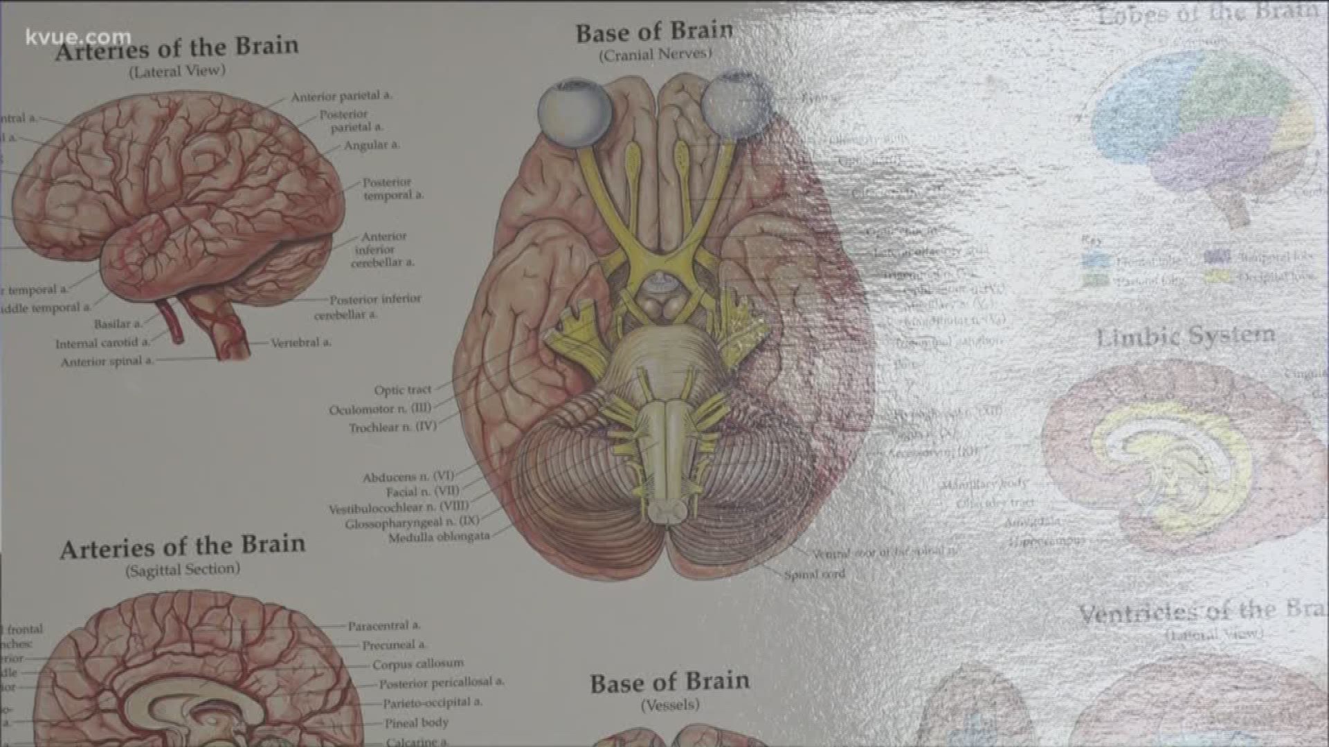 A stroke can happen in an instant, even to the healthiest people.