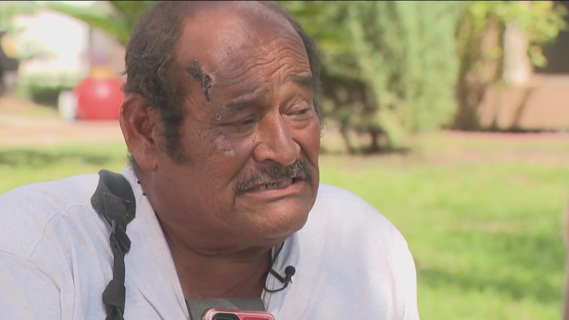 Victim of hit-and-run given free wheelchair - Vimarsana News