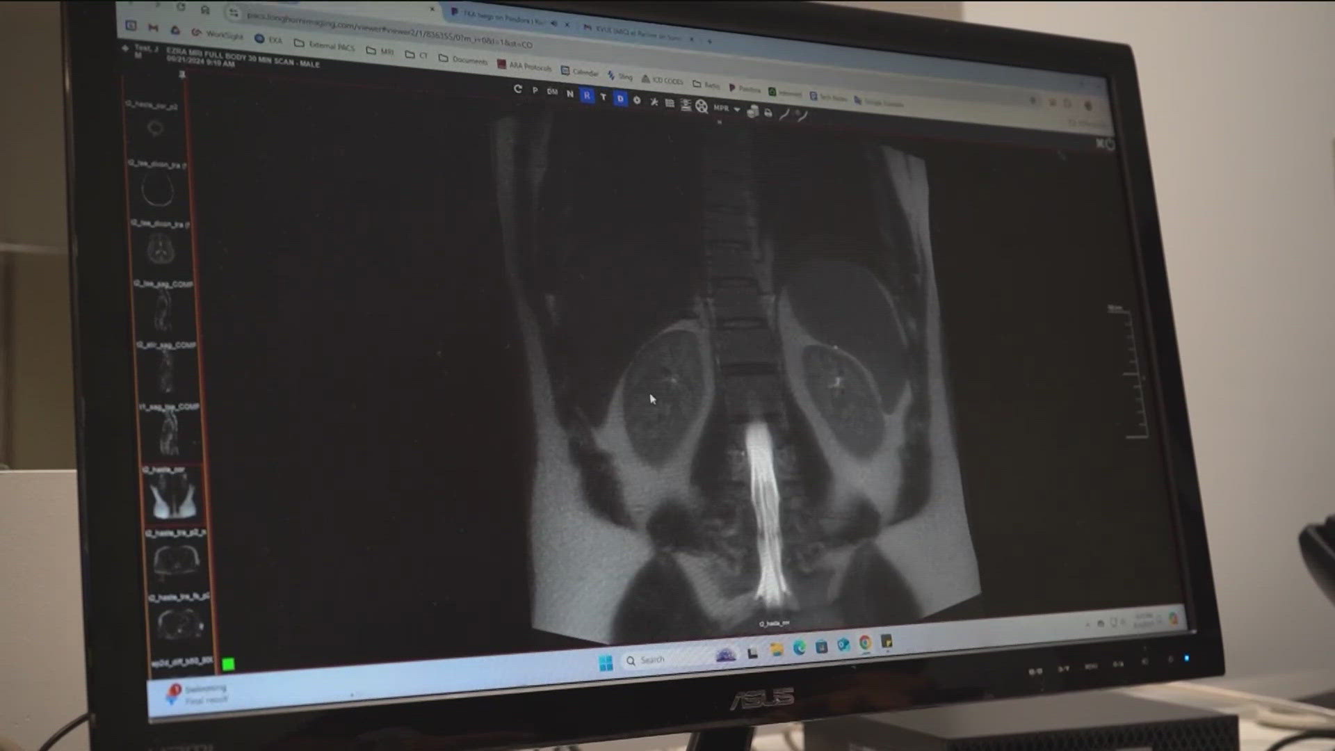 Longhorn Imaging partnered with Ezra to bring full-body MRIs powered by Artificial Intelligence to Central Texas.