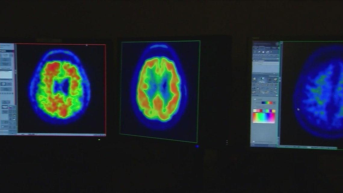 FDA approves new blood test for Alzheimer's detection | kvue.com