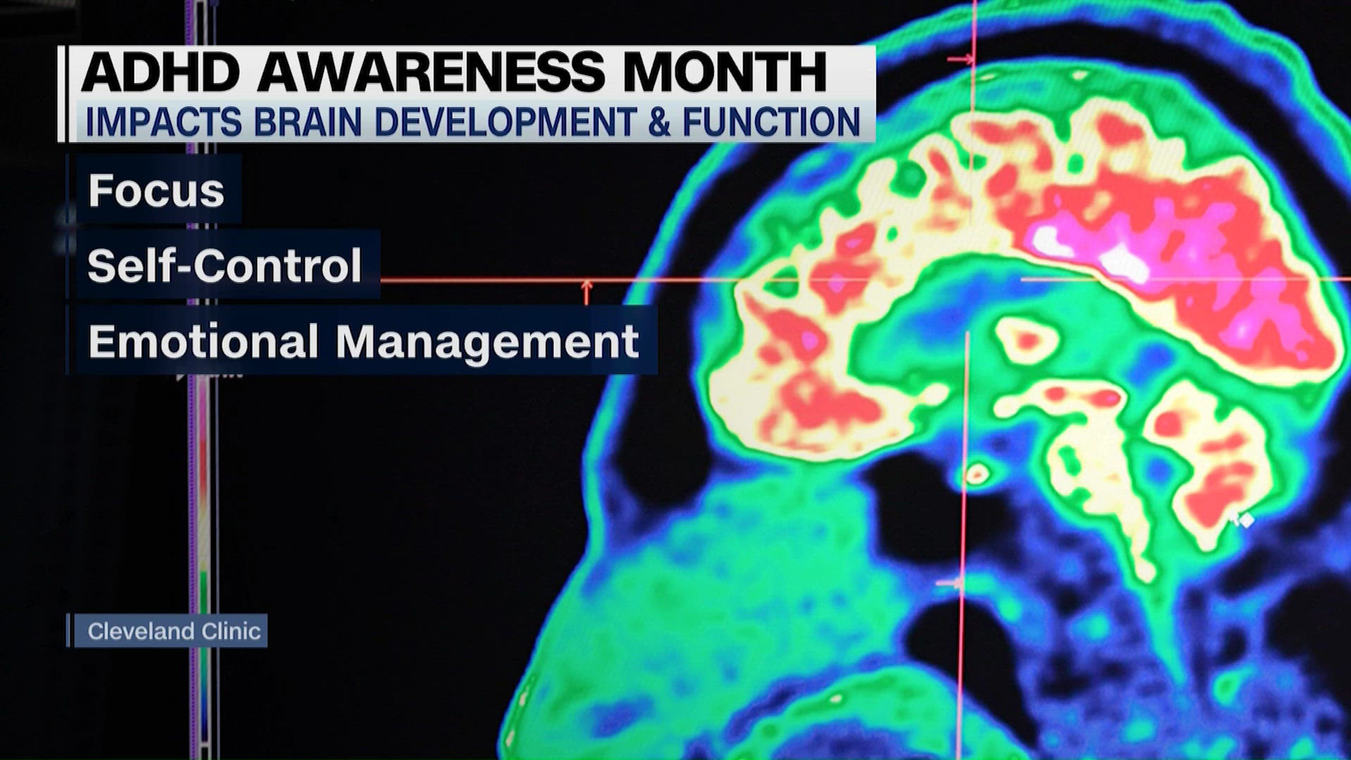 Signs of ADHD in women | ADHD Awareness Month | kvue.com