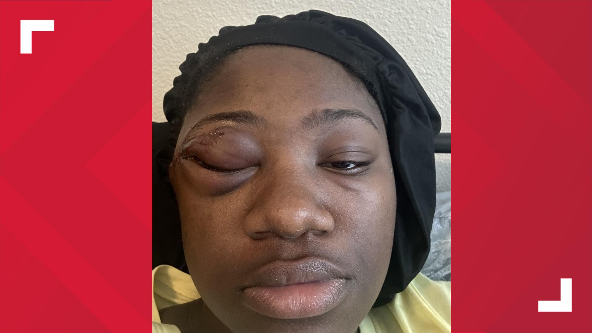 Austin files motion to dismiss lawsuit over 6th Street shooting ...