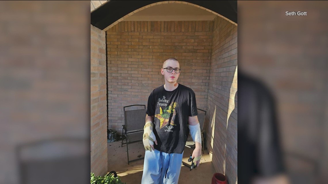 Austin machete attack victim now recovering at home