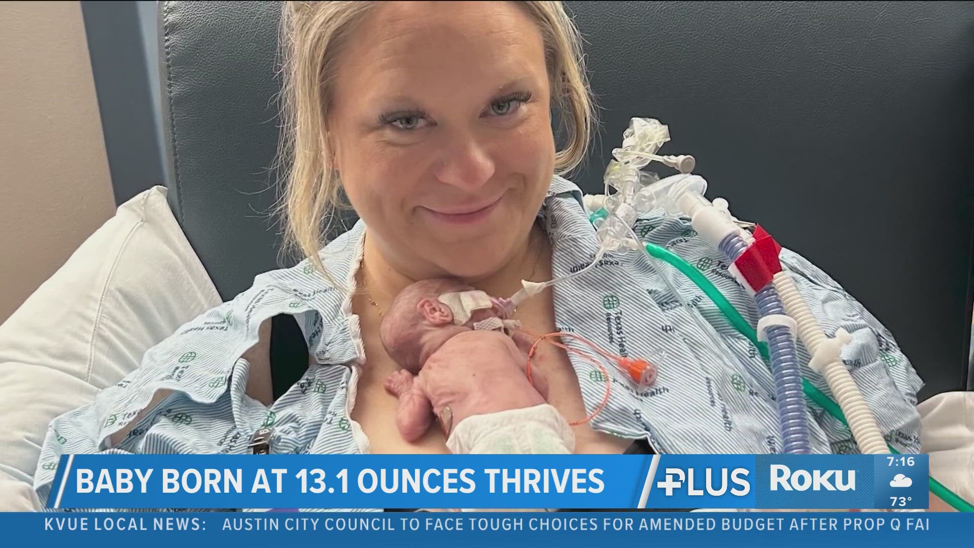 North Texas baby born weighing under 1 pound | kvue.com
