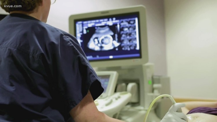 Report: Texas maternal death rate study delayed until next year