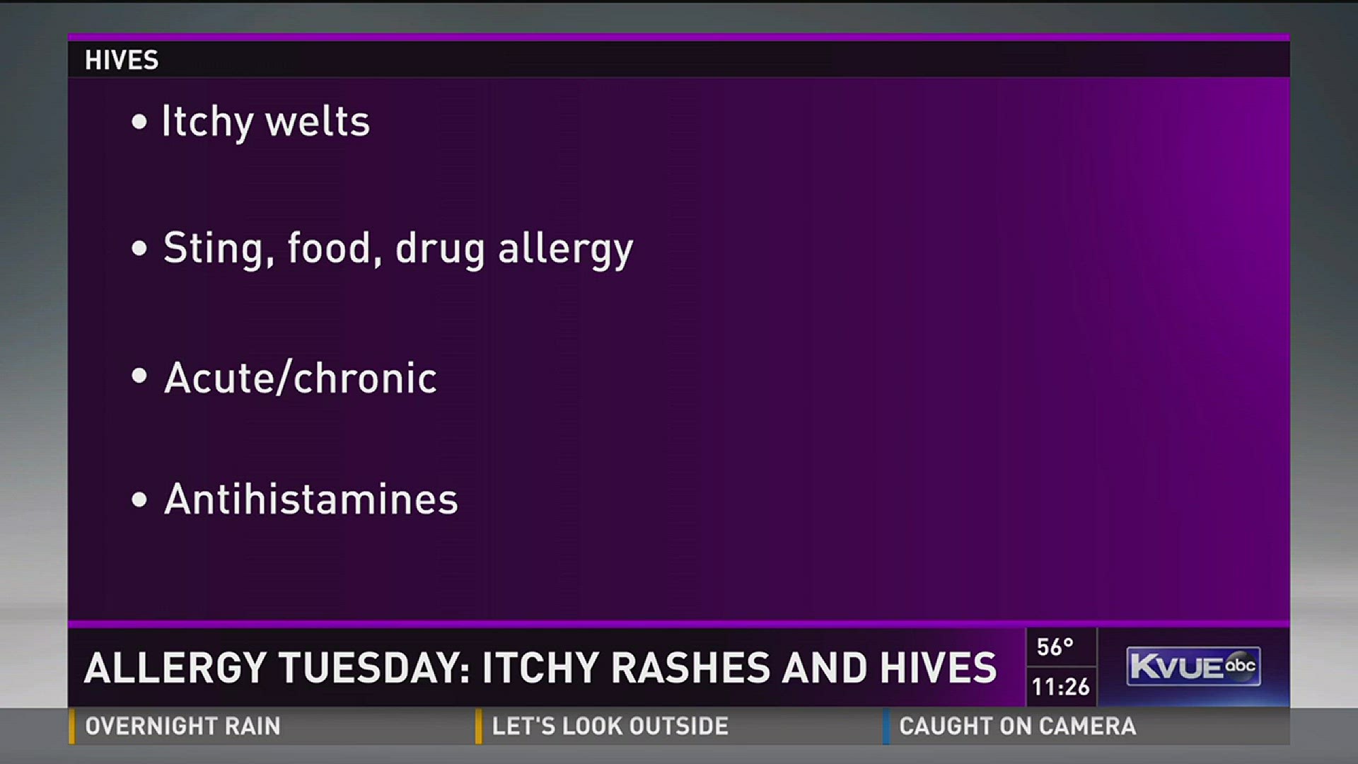 Allergy Tuesday: Treatment for hives