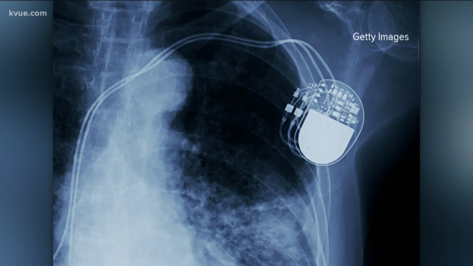 Lawmakers are proposing changes to make it easier to track medical devices.