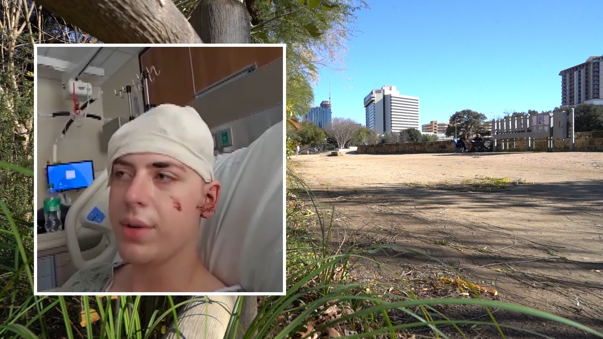 Seth Gott, 19, was attacked by a stranger with a machete on Tuesday near Auditorium Shores in Downtown Austin.