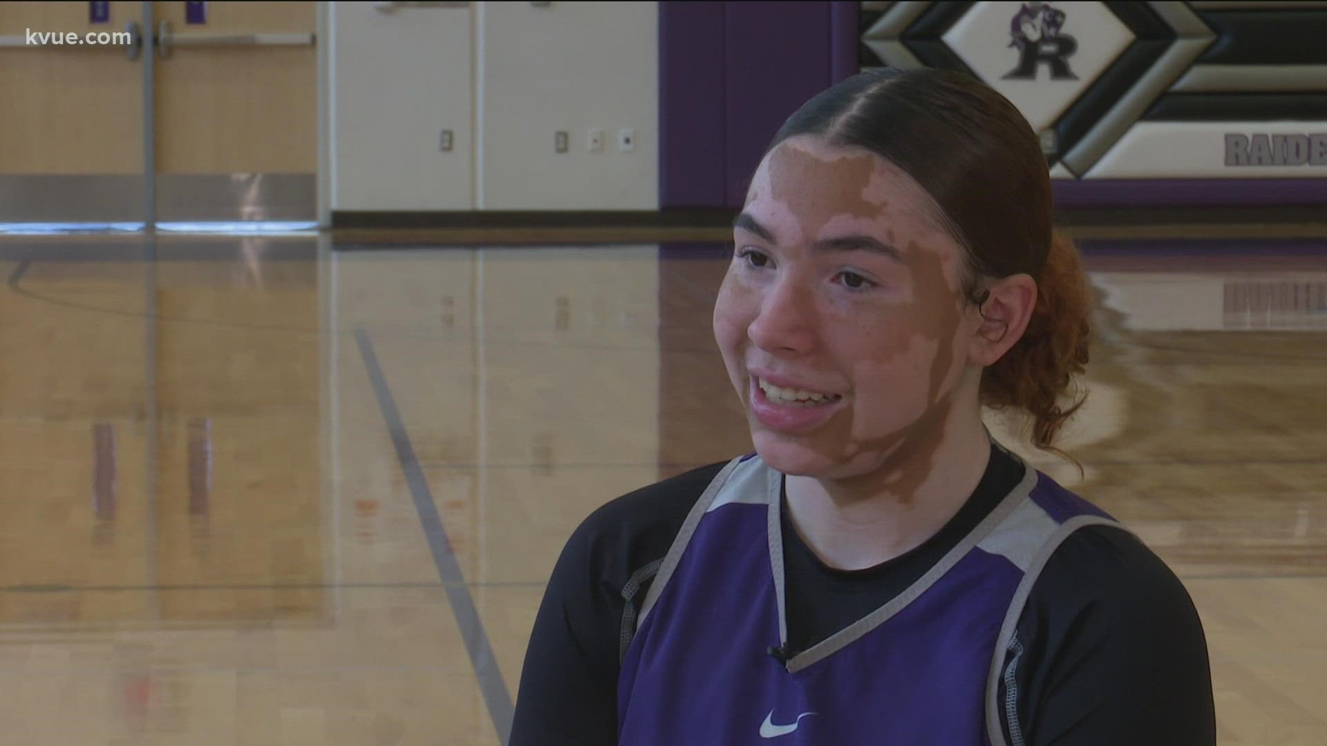 A Cedar Ridge basketball player is finding confidence on the court and in her skin. That path wasn't easy for Lexi Alexander, but basketball gave her a platform.