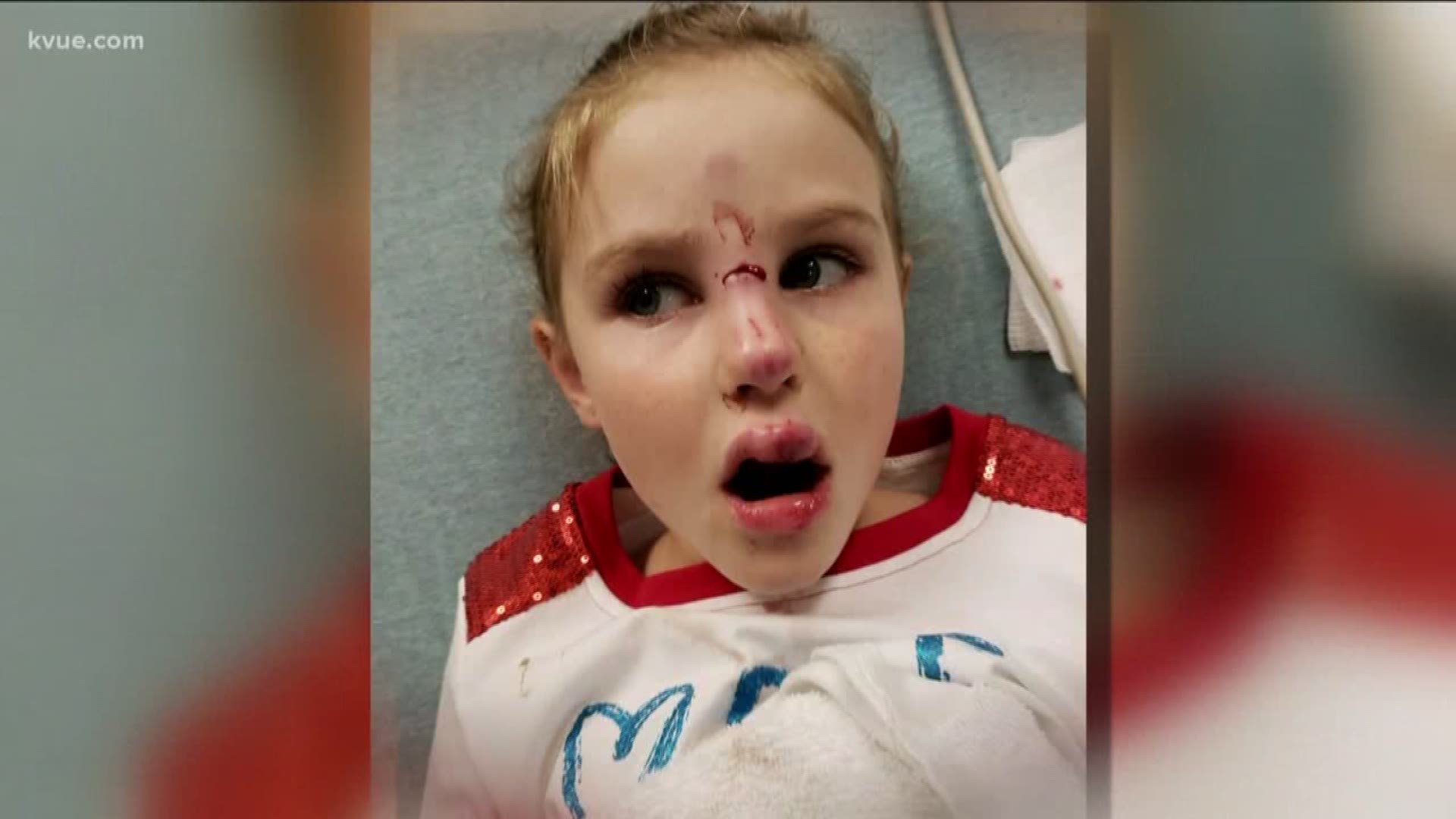 A seven-year-old Georgetown girl is recovering after a dog attacked her face, sending her to the emergency room.
