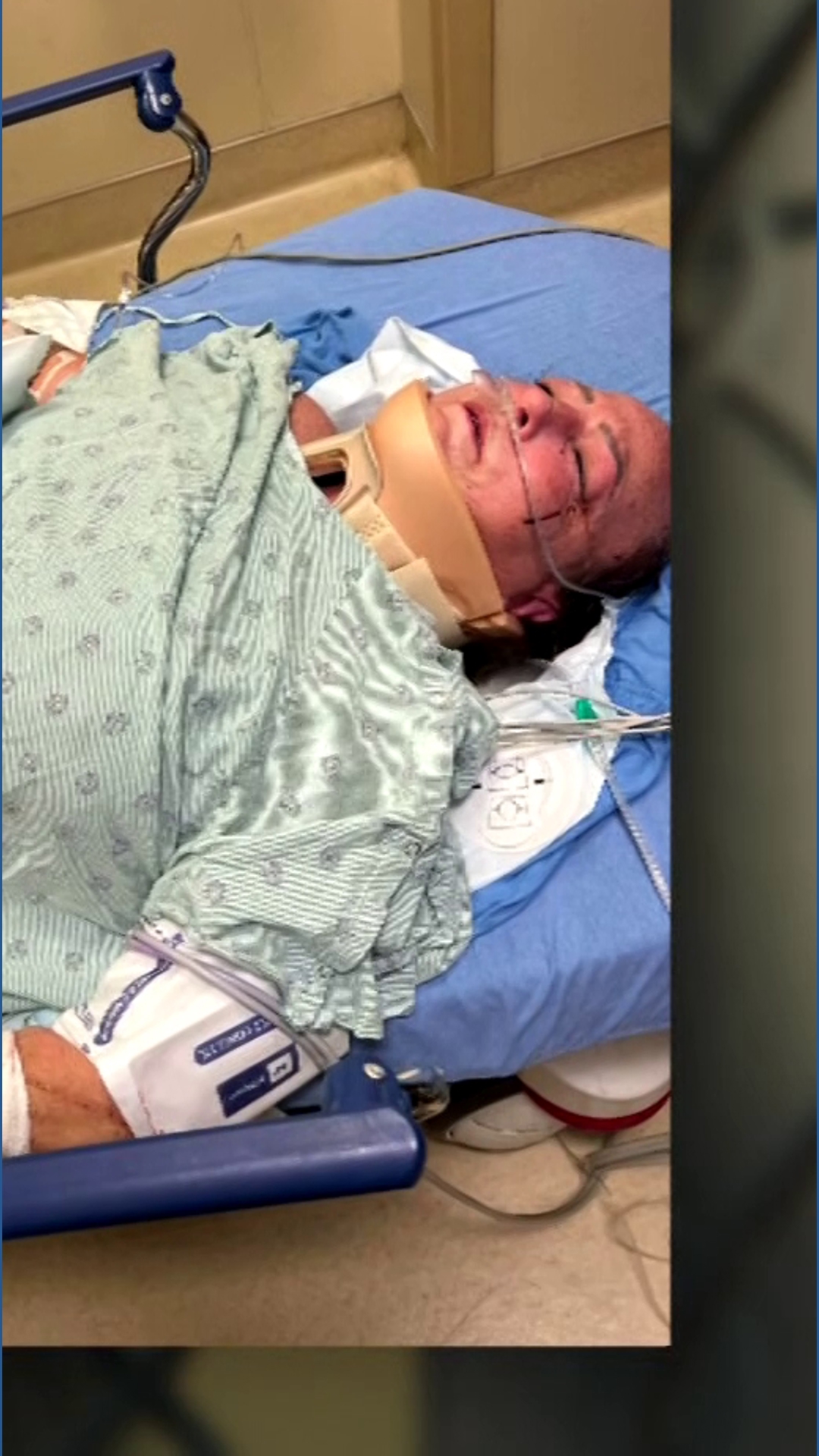 North Texas woman recovering after violent dog attack at park | kvue.com