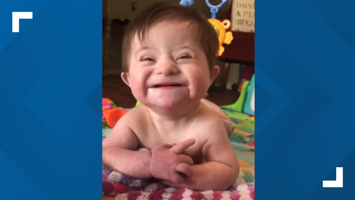 Video of adopted baby with Down syndrome goes viral